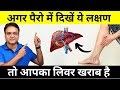 Never Ignore These 9 Warning Signs Of Liver Disease That Come In Your Feet Healthy Hamesha