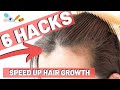 How To Stop Hair Fall Reason You LOSE HAIR In Your Early 20s Stop Doing This Mistake Minal