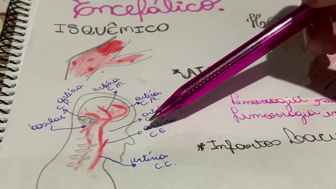 AVE - Acidente Vascular Encefálico: principais artérias e déficits neurológicos