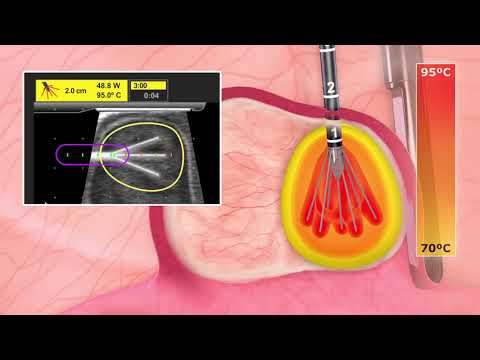 Video from Dr. Katz's YouTube channel