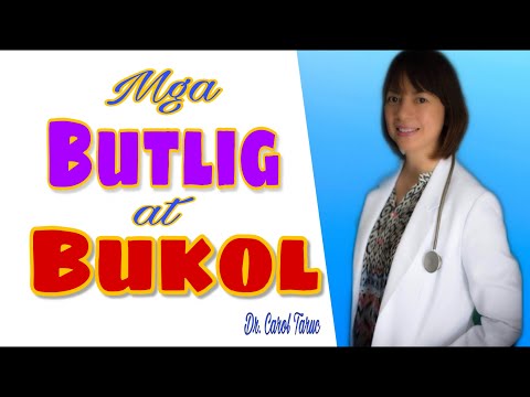 OBGYN vlog . MGA BUTLIG AT BUKOL SA PUWERTA ?  VLOG 38