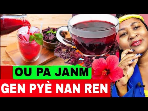 FLÈ CHOUBLAK: tout saw dwe konnen de li