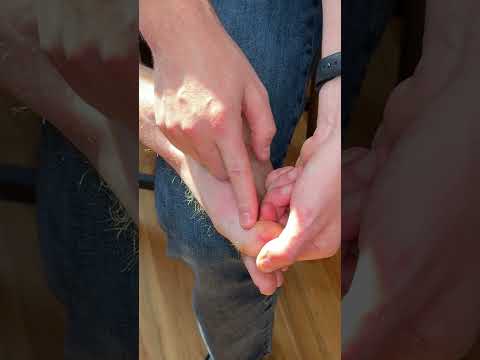 Easy Way to Pop Your Big Toe 💥