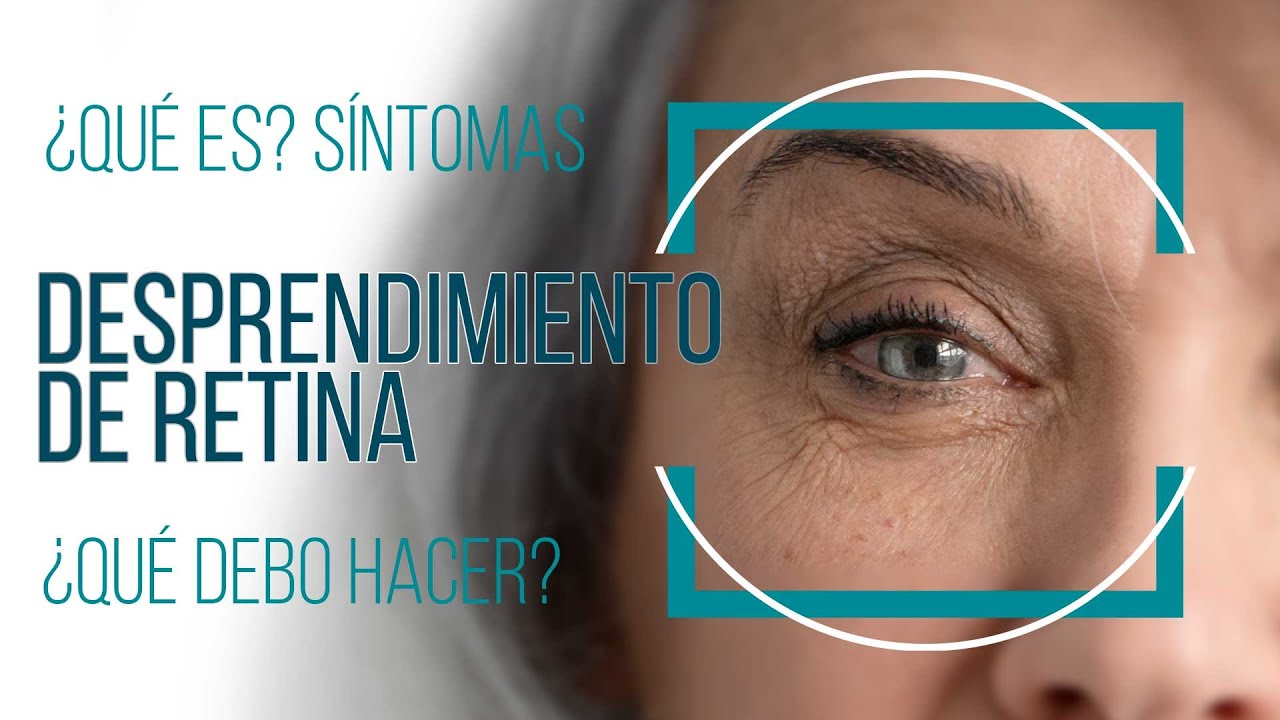 Ángel López Castro-19