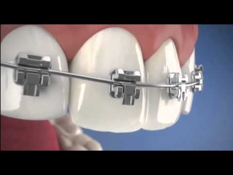 CLINIK TJ PROMOCION ORTODONCIA