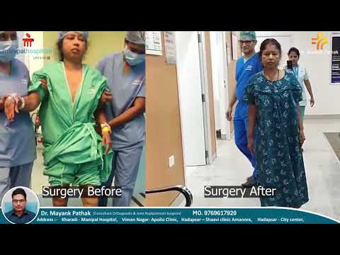Total Knee Replacement: Before &amp; After | Dr. Mayank Pathak