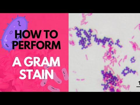 How to Perform a Gram Stain-Microbiology
