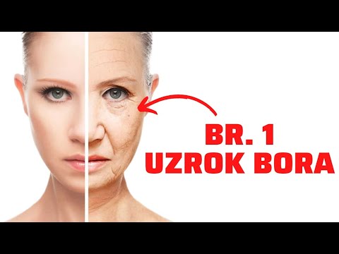 Ovo je uzrok broj jedan BORA i nećete vjerovati o čemu se radi!