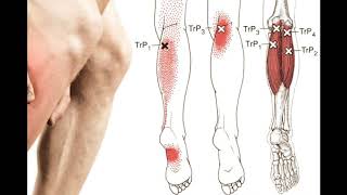 Fibromyalgia | Fibromyalgia Restless Leg Syndrome | Fibromyalgia Treatments | Fibromyalgia Symptoms