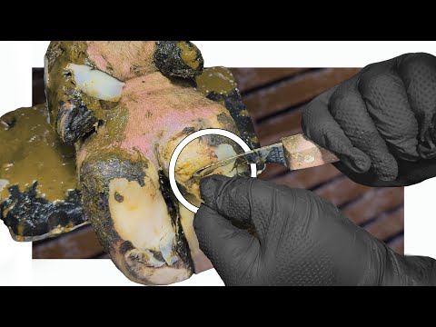 I had to PEEL it all back 😕