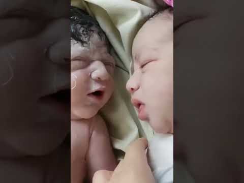 😱😱#love #babies #newborn #drpoonammaggo #shorts #shortsvideo #youtubeshortsvideo #viral