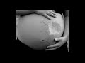 Ruqyah Healer Of The Magic Of Non Reproduction And Repeated Miscarriage Ruqyah Shariah