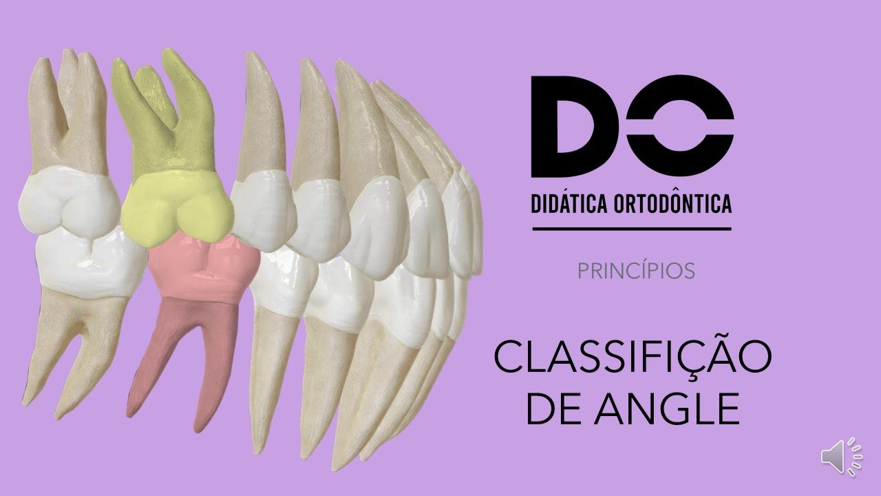 CLASSIFICAÇÃO DE ANGLE - Princípios da Ortodontia  parte 1.