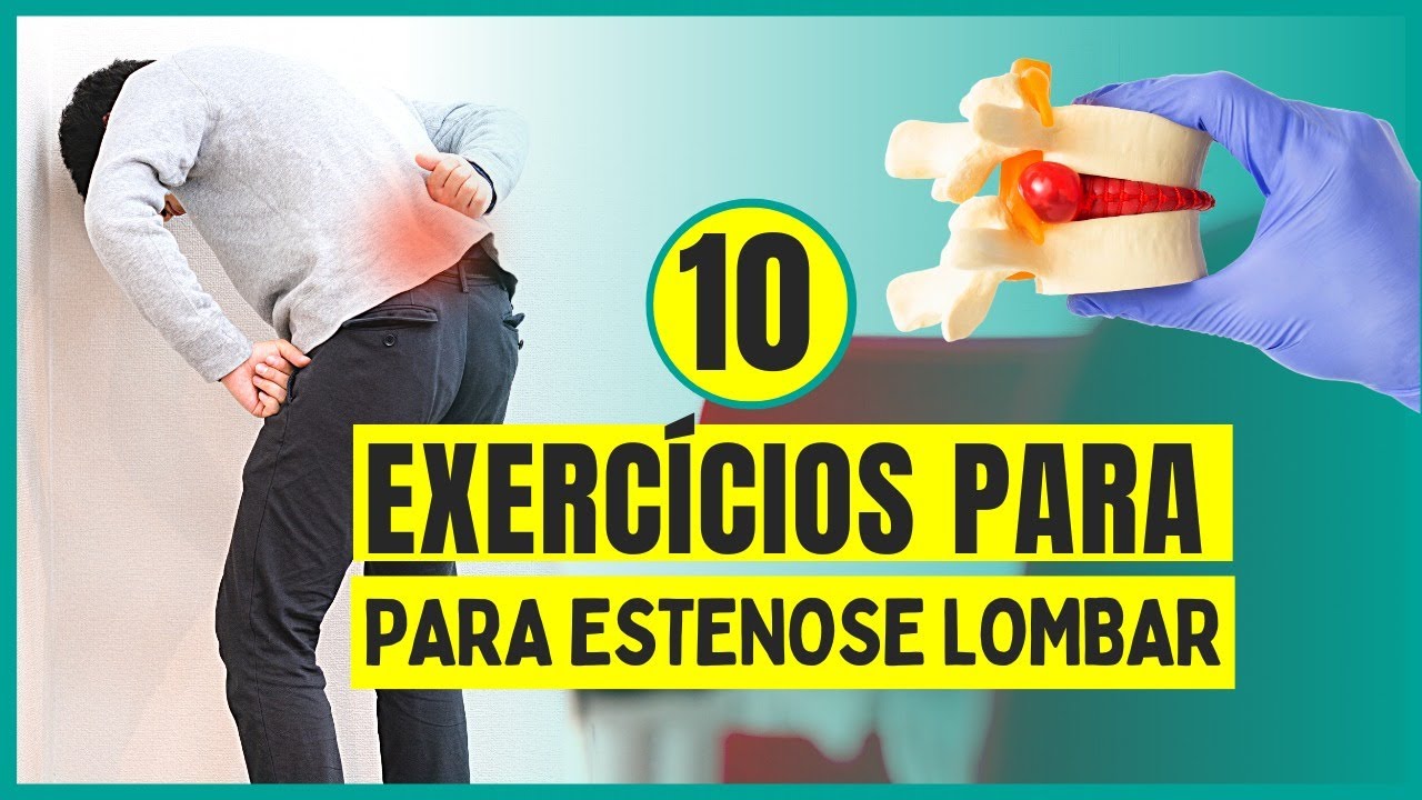 10 DICAS PARA MELHORAR DA ESTENOSE LOMBAR SEM CIRURGIA