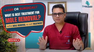 What is the Best Treatment for Mole Removal ! Mole removal in Delhi | Mole removal by Laser