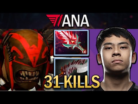 Bloodseeker Dota 2 7.32 Gameplay T1.Ana with 32 Kills and Abyssal #dota2 #dota2gameplay