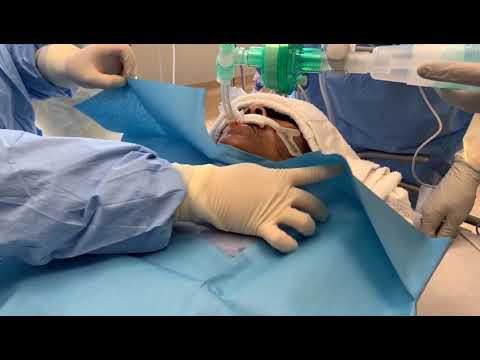 Percutaneous tracheostomy