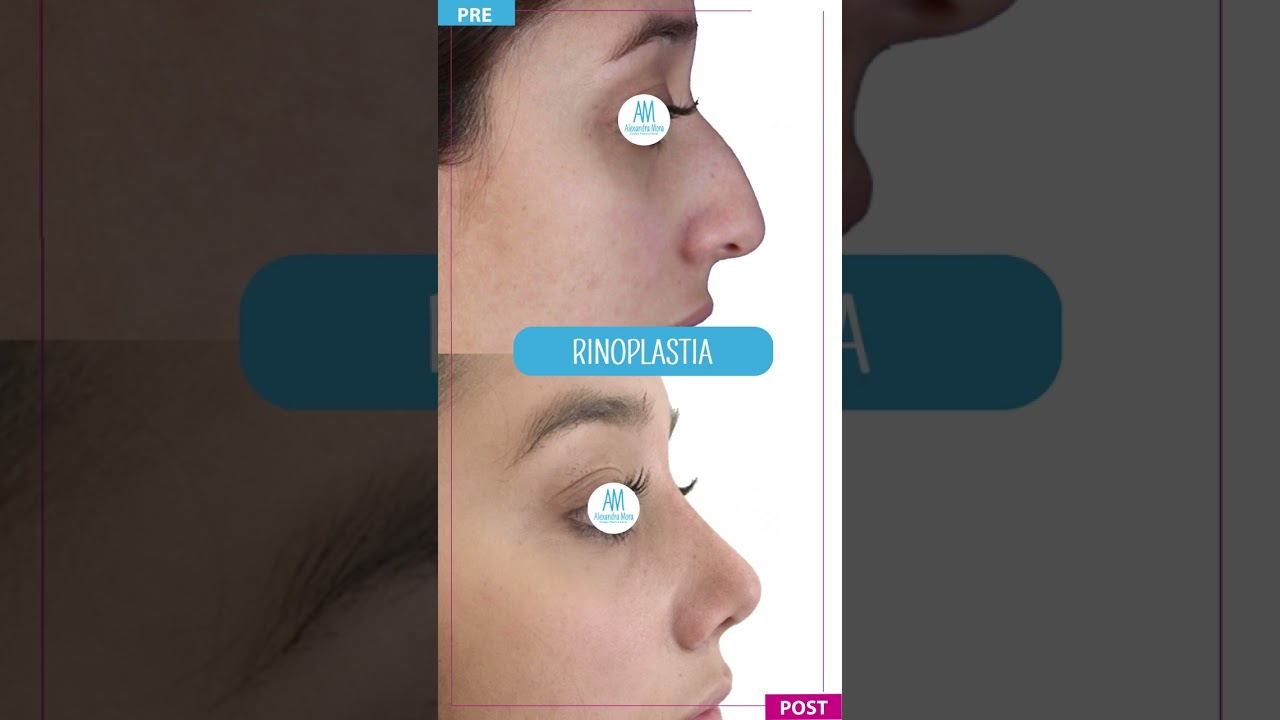 Alexandra Mora Hernandez-113