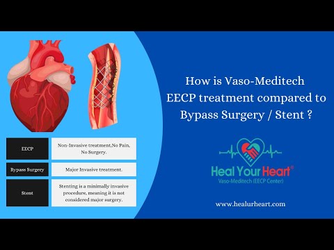 Is Vaso-Meditech EECP is an Alternative for Bypass Surgery or Stent?