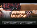 Aneurysm Nirvana Cover Guitar Tab Lesson Tutorial