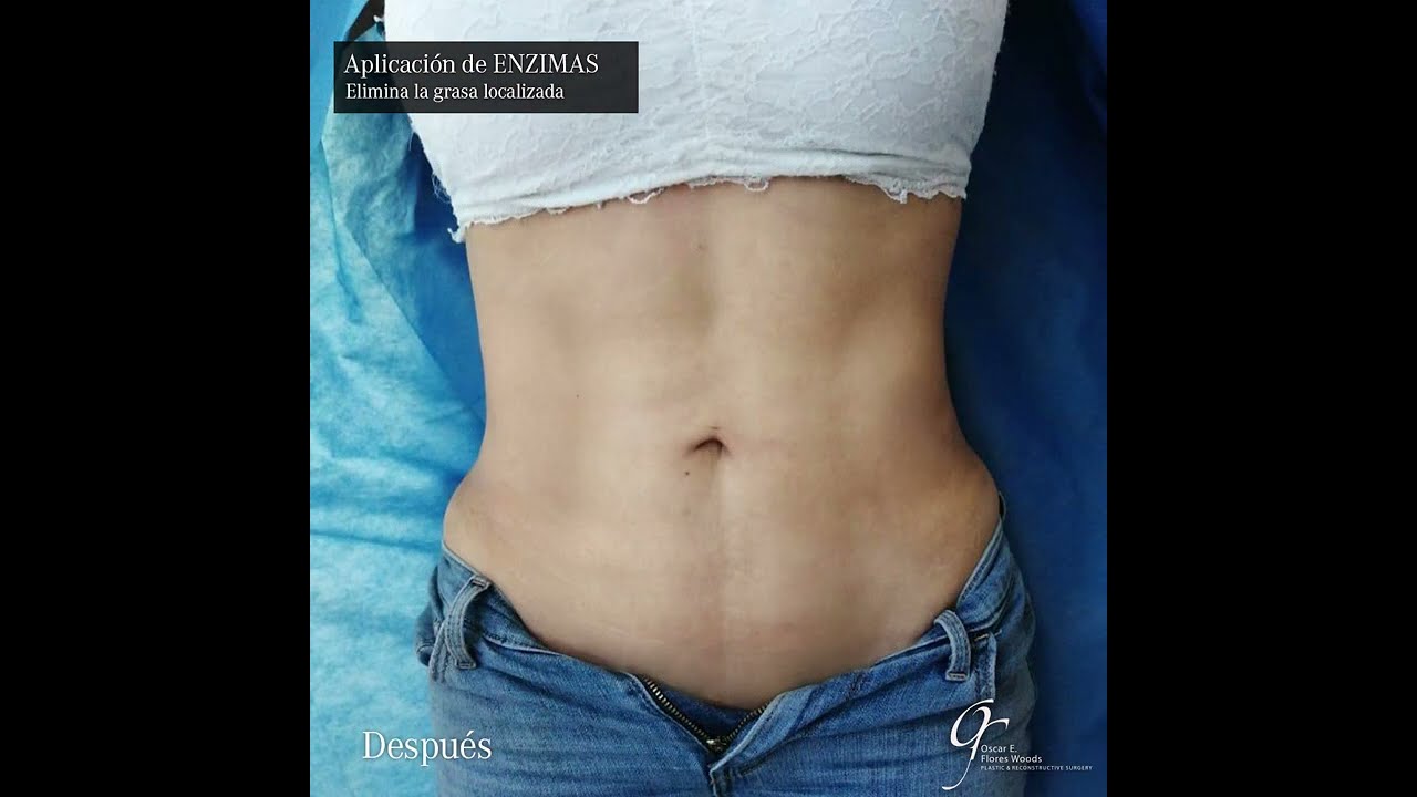 Oscar Eduardo Flores Woods-17