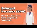 Enlarged Prostate (BPH) - What It Is, Symptoms, Risks, Diagnosis & Treatments