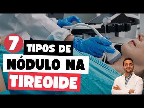 Descubra os 7 Tipos Mais Comuns de Nódulo na Tireoide e Como Identificá-los