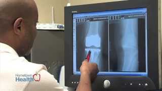 Florida Hospital Waterman's Joint Replacement Center - Advances in Knee Surgery Florida Hospital Waterman's Joint Replacement Center - Advances in Knee Surgery