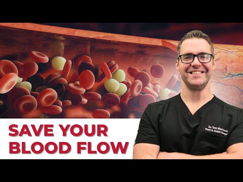 Top 15 Clogged Artery & Circulation Foods! [High Vitamin K2 Foods]
