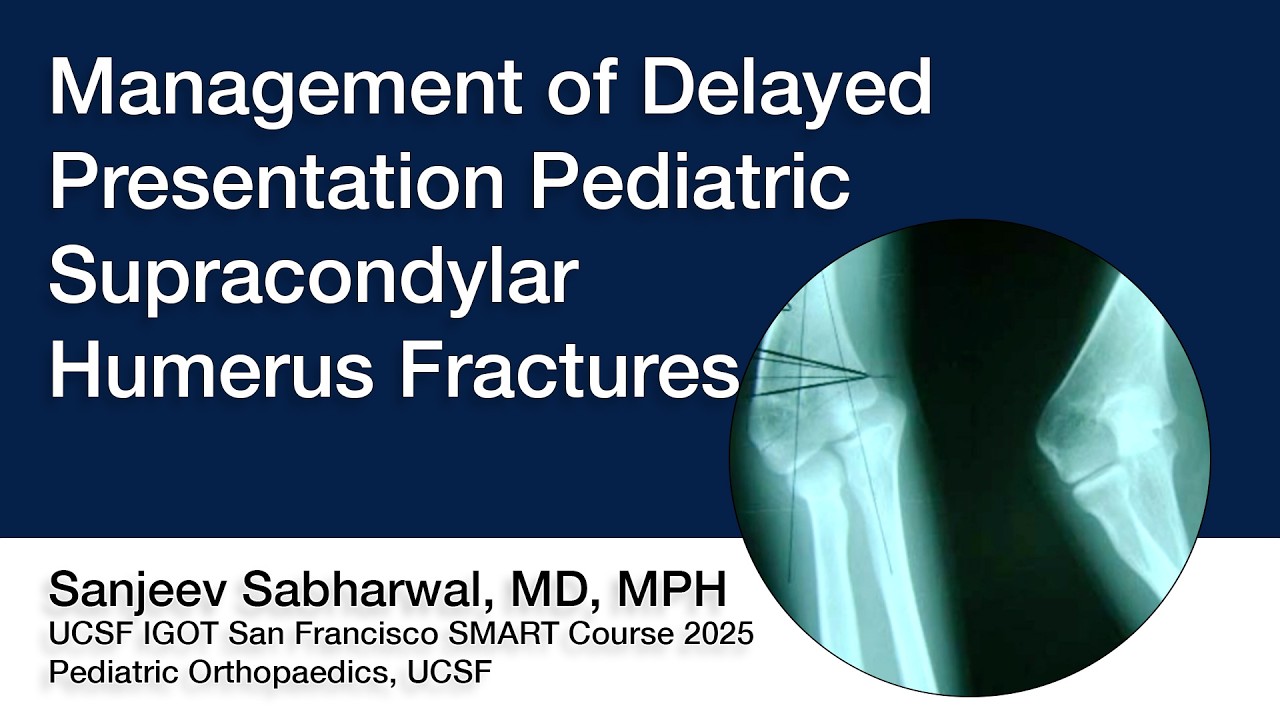 Management of Delayed Presentation Pediatric Supracondylar Humerus Fractures | S. Sabharwal, MD, MPH