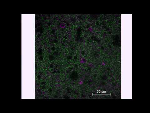 R. Mark Wightman: Electrochemical  Monitoring of Neurotransmitters and Metabolites