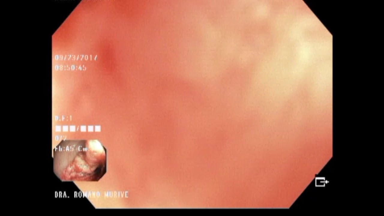 Adriana Fabiola Romano Munive-26