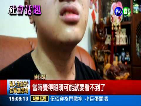 石頭堆架網烤肉 高溫爆裂灼傷眼