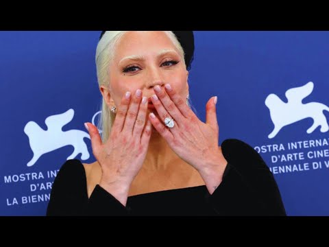 New Update!! Breaking News Of Lady Gaga || It will shock you