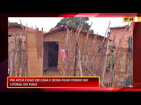 Criança de 3 anos tem o corpo queimado em inceÌ‚ndio causado pelo pai em ParnaiÌba 22 01 2021