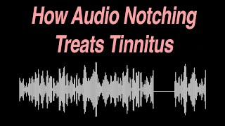 How Audio Notching Treats Tinnitus