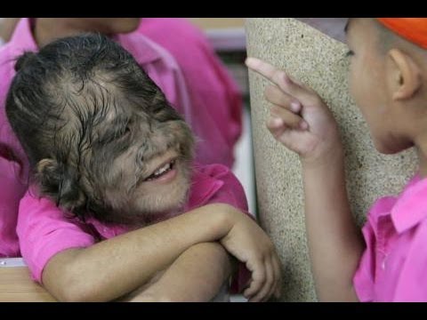 DOKU ● Mysteriöse Krankheiten - Unfassbare Entdeckungen ● Dokumentation Deutsch 2014