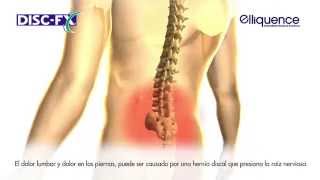 Nueva técnica con Radiofrecuencia para el tratamiento de Dolor Lumbar