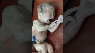 how baby looks when born #baby #newborn #birth #cute #shorts #viral