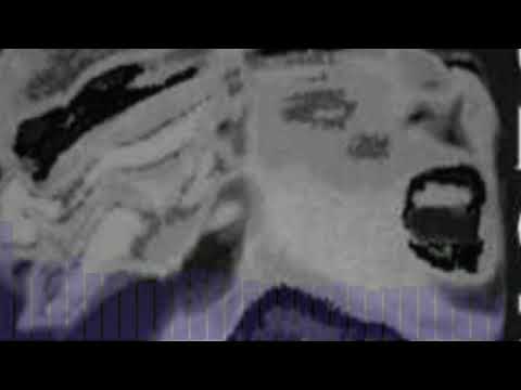 BLOK 57 - Fuck You.1992 🇩🇪