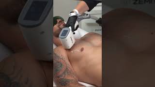 Zemits Quidion - The Unique Diode Laser with an updated control system 🔥 #shorts #Zemits