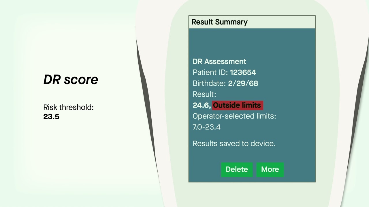 A Superior DR Progression Risk Assessment with the RETeval Device — Mitch Brigell, PhD