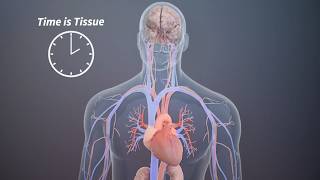 LifeFlow PLUS - Rapid Infuser by 410Medical - 3D Medical Animation