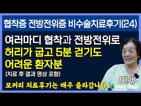 치료후기사진 입니다.