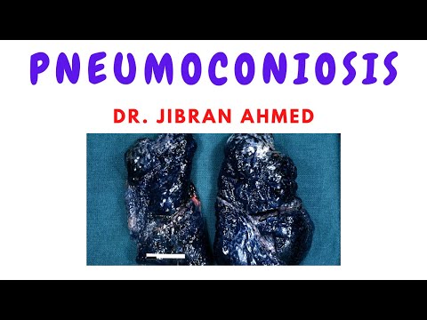 LUNG TUMOURS II SYSTEMIC PATHOLOGY II ROBBINS 10TH E II PATHOLOGY LECTURES II DrJIBRANAHMED