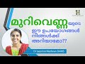 Murivenna മുറിവെണ്ണ ഉപയോഗങ്ങൾ Dr Jaquline