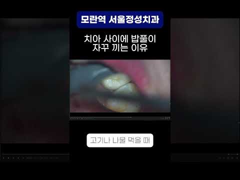 땡큐성형외과 Clips