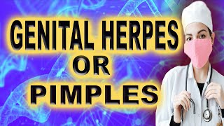 genital herpes or pimples