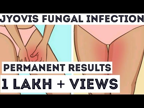 Yellow kuko syndrome paggamot Unguento ng halamang-singaw sa paanan