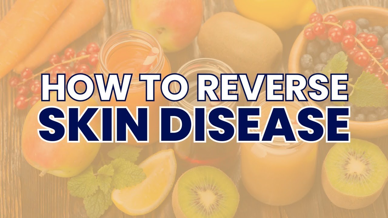 How To Reverse Skin Disease With Raw Food and Juice
